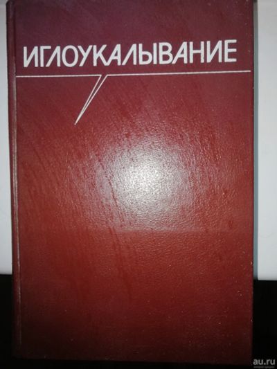 Лот: 15932905. Фото: 1. Иглоукалывание 1989г. Популярная и народная медицина