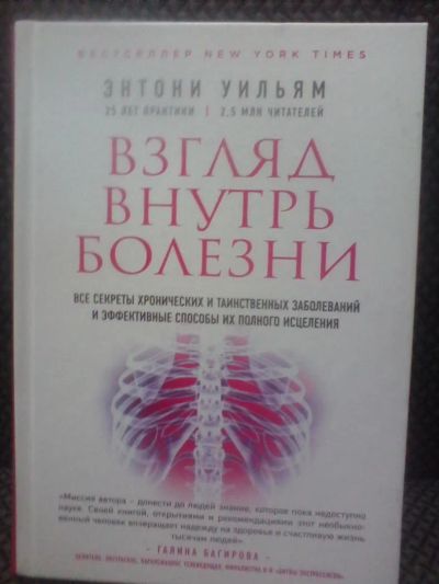 Лот: 10692419. Фото: 1. Энтони УИЛЬям "Взгляд внутрь болезни... Популярная и народная медицина