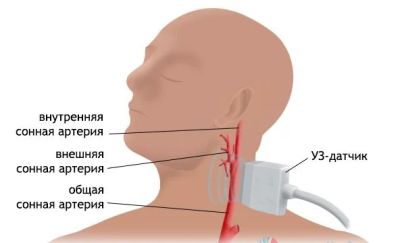 Лот: 11723064. Фото: 1. Сертификат на ультразвуковое исследование... Другое (медицина)