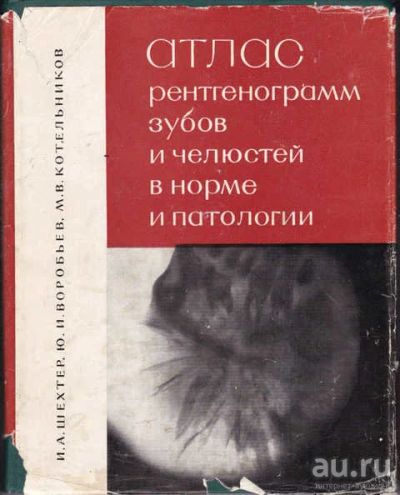 Лот: 14016677. Фото: 1. Атлас рентгенограмм зубов и челюстей... Традиционная медицина