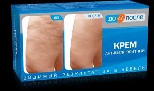 Лот: 23730202. Фото: 1. До и После Крем для тела антицеллюлитный... Лекарства