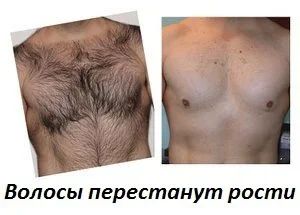 Лот: 11103170. Фото: 1. Снимай шубу БЕЗ БОЛИ. Навсегда... Другие (красота, здоровье, медицина)