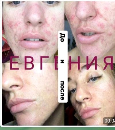 Лот: 11836913. Фото: 1. Детокс-программа очищения организма. Другое (медицина)