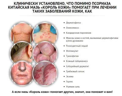 Лот: 8533204. Фото: 1. Король кожи для рук. Уход за телом