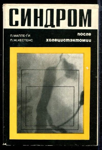 Лот: 23432818. Фото: 1. Синдром после холецистэктомии. Традиционная медицина