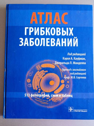 Лот: 25323484. Фото: 1. Атлас грибковых заболеваний. Традиционная медицина