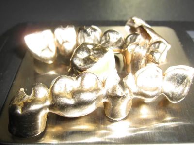 Лот: 16141576. Фото: 1. Куплю зубные коронки золотые. Лом ювелирных изделий