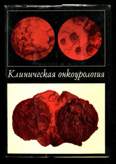Лот: 23435689. Фото: 1. Клиническая онкоурология. Традиционная медицина