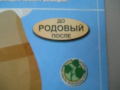 Лот: 14547031. Фото: 1. Бандаж. Ортопедические изделия