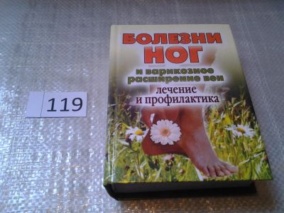 Лот: 6208627. Фото: 1. оз (13..02) Болезни ног и варикозное... Популярная и народная медицина