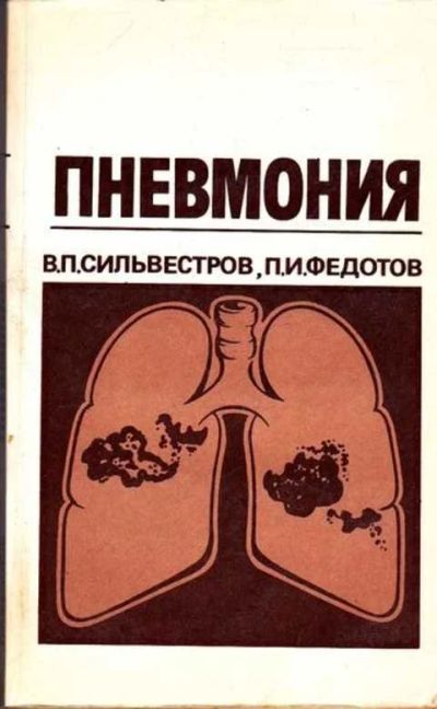 Лот: 12261531. Фото: 1. Пневмония. Традиционная медицина