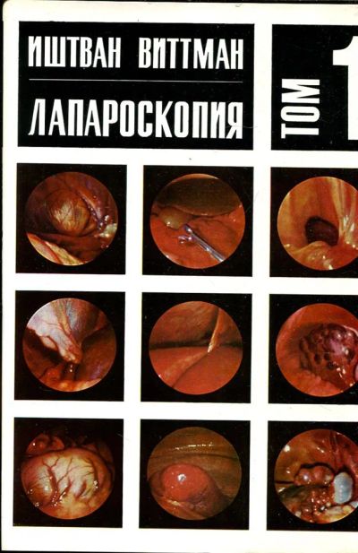 Лот: 23432983. Фото: 1. Лапароскопия | В двух томах. Том... Традиционная медицина