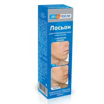 Лот: 23716640. Фото: 1. До и после лосьон Анти-акне д... Лекарства