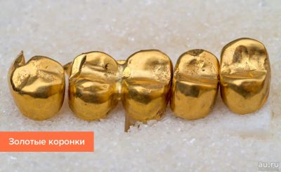 Лот: 10427942. Фото: 1. Куплю стоматологическое золото. Лом ювелирных изделий