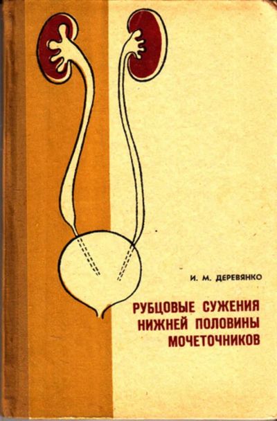 Лот: 23443100. Фото: 1. Рубцовые сужения нижней половины... Традиционная медицина