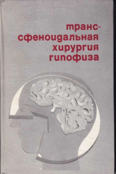 Лот: 23442348. Фото: 1. Транссфеноидальная хирургия гипофиза. Традиционная медицина