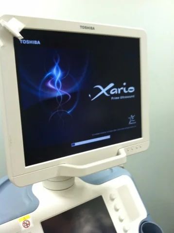 Лот: 3551119. Фото: 1. Toshiba Xario, LCD. Оборудование