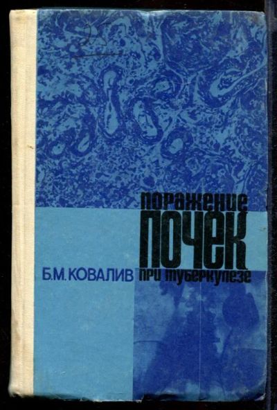 Лот: 23432154. Фото: 1. Поражение почек при туберкулезе... Традиционная медицина