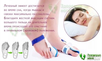 Лот: 8561226. Фото: 1. Бандаж большого пальца ноги от... Ортопедические изделия
