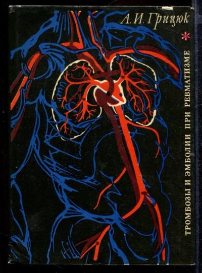 Лот: 23432744. Фото: 1. Тромбозы и эмболии при ревматизме. Традиционная медицина