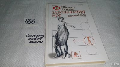 Лот: 9999754. Фото: 1. Заболевания ног. Лечение и профилактика... Другое (медицина и здоровье)