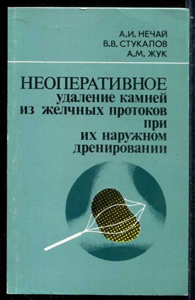Лот: 23433889. Фото: 1. Неоперативное удаление камней... Традиционная медицина