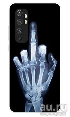 Лот: 16285342. Фото: 1. Чехол-накладка для Xiaomi Mi Note... Чехлы, бамперы