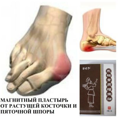 Лот: 8506192. Фото: 1. Китайский магнитный пластырь Hyperosteogeny... Народная медицина, БАДы