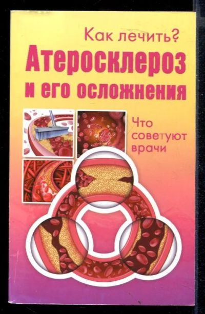 Лот: 23430193. Фото: 1. Как лечить? Атеросклероз и его... Популярная и народная медицина