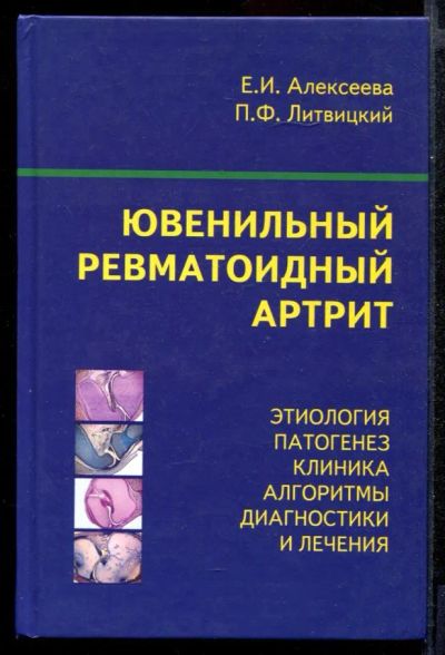 Лот: 23431793. Фото: 1. Ювенильный ревматоидный артрит. Традиционная медицина