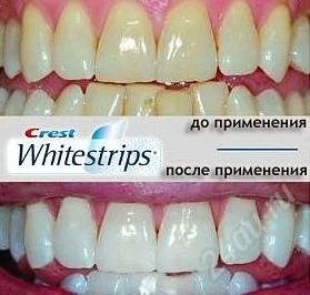 Лот: 2242370. Фото: 1. Отбеливающие полоски для зубов. Средства личной гигиены 