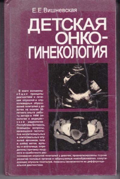 Лот: 14017802. Фото: 1. Детская онкогинекология. Традиционная медицина