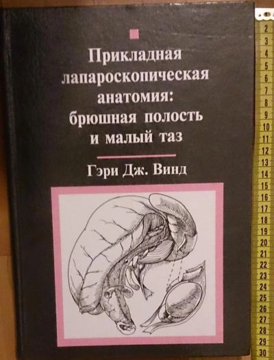 Лот: 7631395. Фото: 1. Гэри Винд. Прикладная лапароскопическая... Традиционная медицина