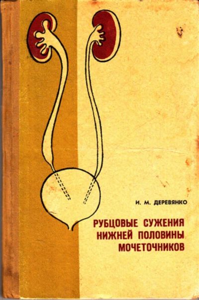 Лот: 23443101. Фото: 1. Рубцовые сужения нижней половины... Традиционная медицина