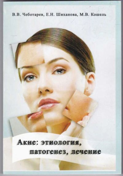 Лот: 23441201. Фото: 1. Акне: этиология, патогенез, лечение. Традиционная медицина