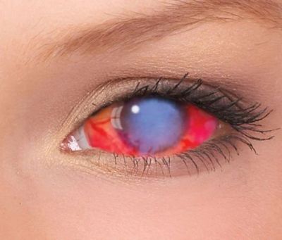 Лот: 14854775. Фото: 1. CRAZY. SCLERa. СКЛЕРы. Склеральные... Контактные линзы