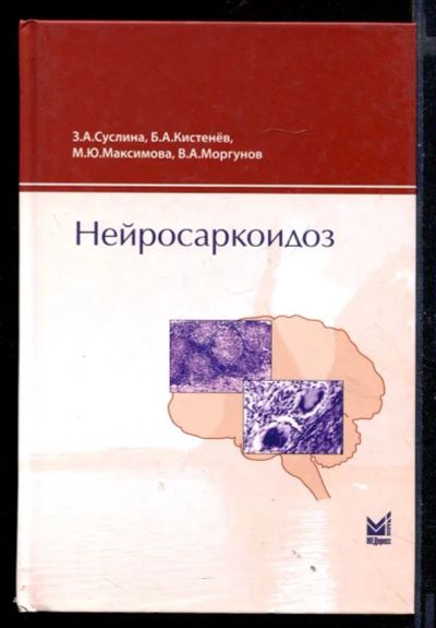 Лот: 23430776. Фото: 1. Нейросаркоидоз. Традиционная медицина