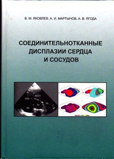 Лот: 23445968. Фото: 1. Соединительные дисплазии сердца... Традиционная медицина