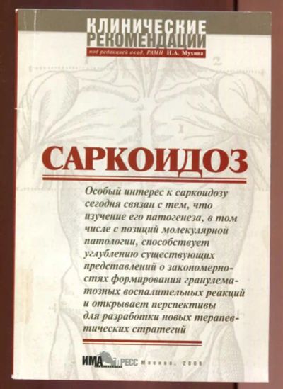 Лот: 23437590. Фото: 1. Саркоидоз. Клинические рекомендации. Традиционная медицина