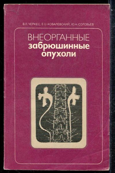 Лот: 23433864. Фото: 1. Внеорганные забрюшинные опухоли. Традиционная медицина