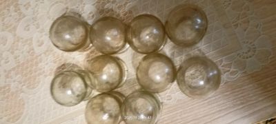 Лот: 25896262. Фото: 1. Банки для прогревания. Медицинские товары