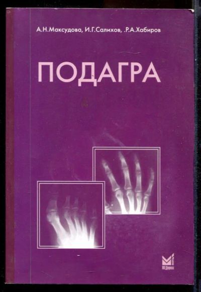Лот: 23431491. Фото: 1. Подагра. Традиционная медицина