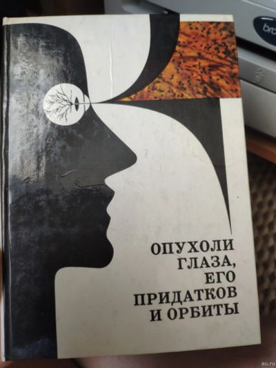 Лот: 13614253. Фото: 1. Опухоли глаза, его придатков и... Традиционная медицина