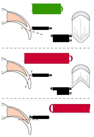 Приспособление для стрижки когтей у кошек. Сумка для стрижки когтей кошек. Можно ли подстричь когти обычными ножницами. Можно ли подстричь когти обычными ножницами. Как подстричь собаке когти когтерезом.
