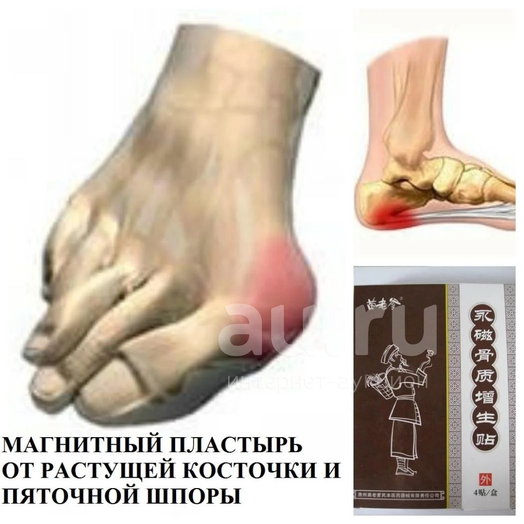 Китайский магнитный пластырь Hyperosteogeny от растущей косточки ...